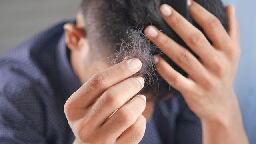 New Hair Loss Drug Approved by FDA