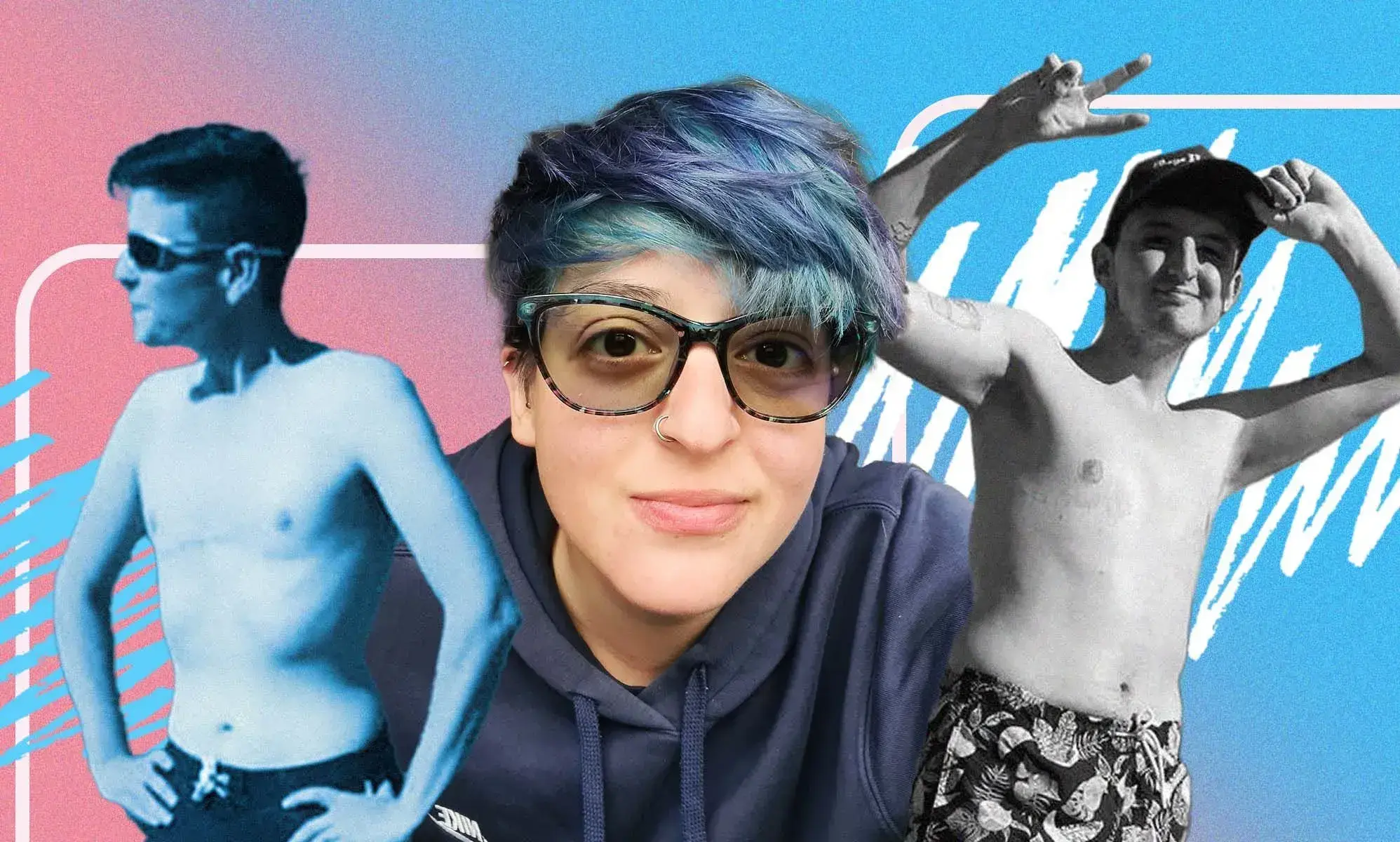 ‘I woke up as me’: Trans and non-binary people on joy of having top surgery