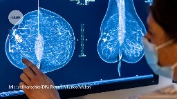 Huge leap in breast-cancer survival rate